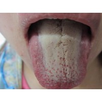 哪些中药有祛暑、防中暑作用