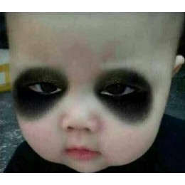 中医祛除黑眼圈