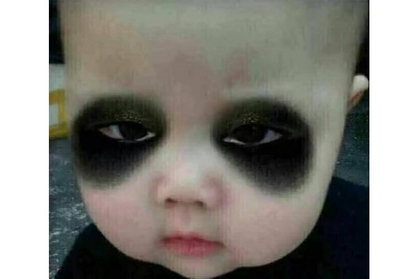 中医祛除黑眼圈