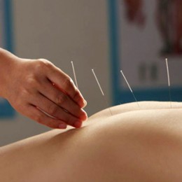 什么是针灸？