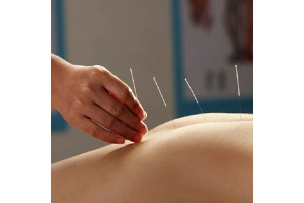 什么是针灸？